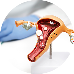 기존 피부 속만 재생하는 레이저